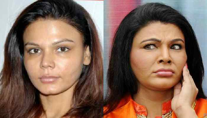 Rakhi Sawant Plastic Surgery Disaster Nose Job, Breast Implant Before Now