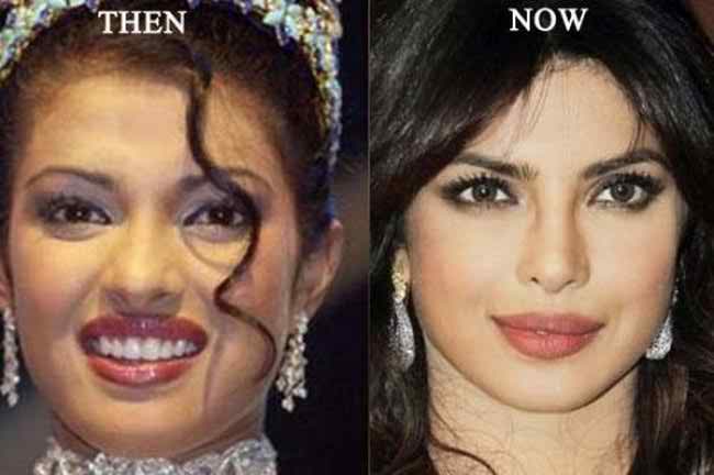 Priyanka Chopra Plastic Surgery Body Sizes Before Miss World now