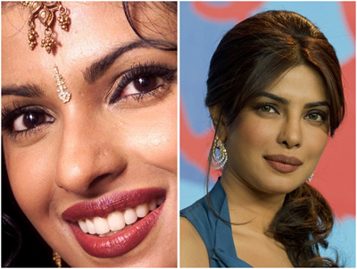 Priyanka Chopra Nose Job plastic surgery before and now pictures