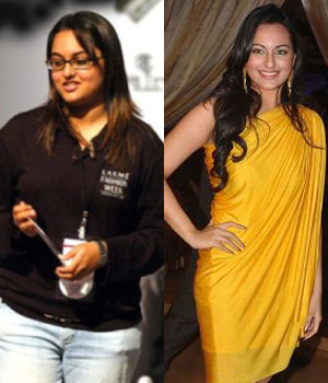 Sonakshi Sinha before and after weight loss surgery pictures