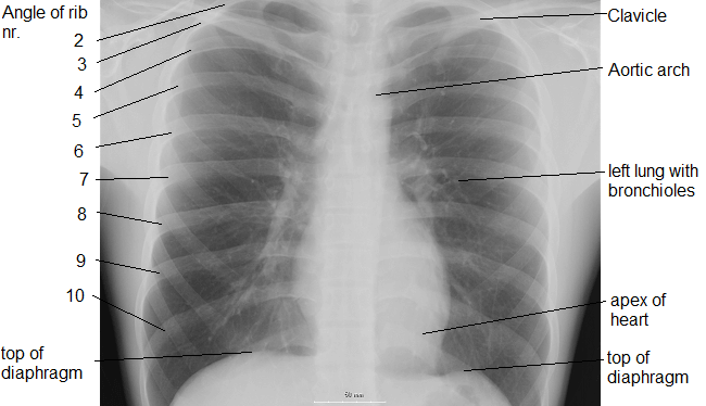 A chest radiograph cost