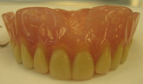 Snap On Smile artificial teeth cost